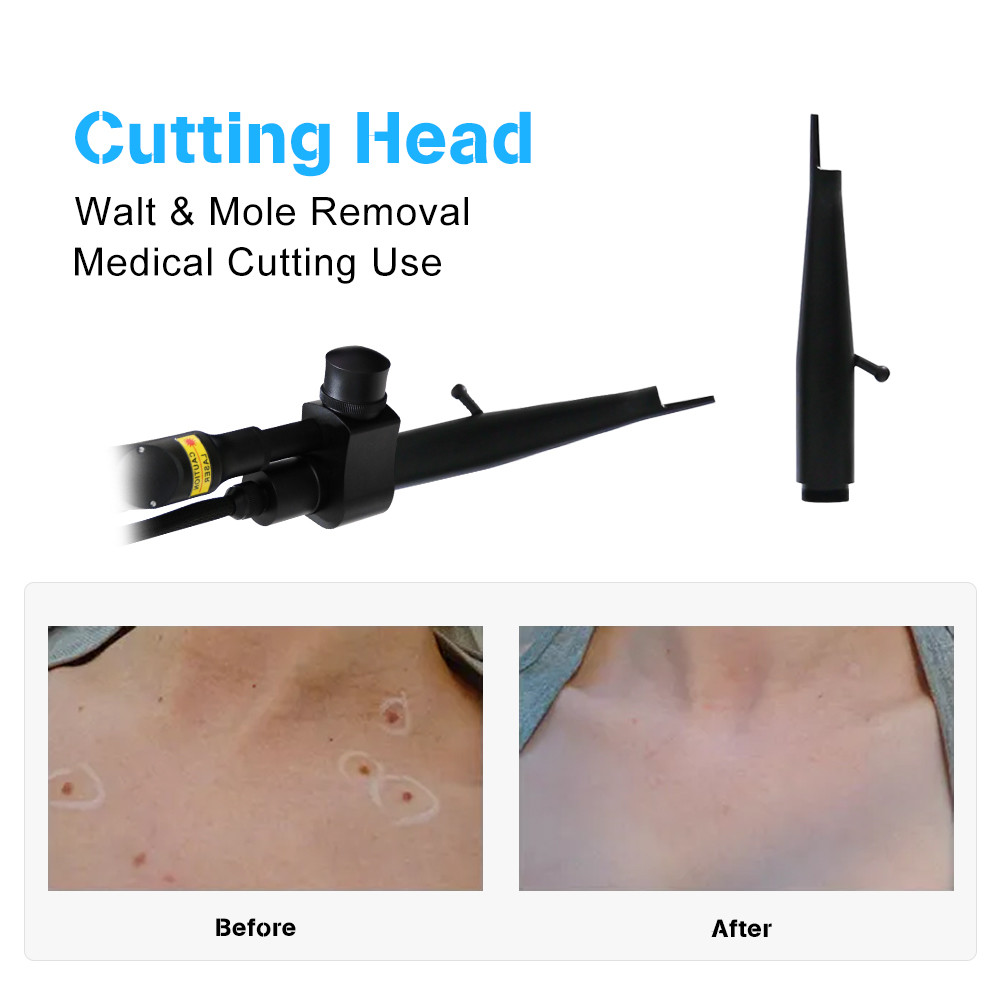 ZGV13-04 Latest Rf Tube Co2 Laser Skin Care Machine 30w Power Remove Acne Marks Remove Freckles And Scars Smooth Device