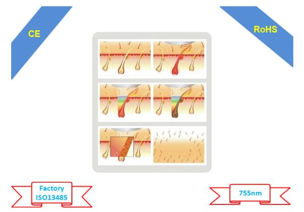 Alexandrite Laser Machine Hair Removal Permanent , Painless Alexandrite Lasers