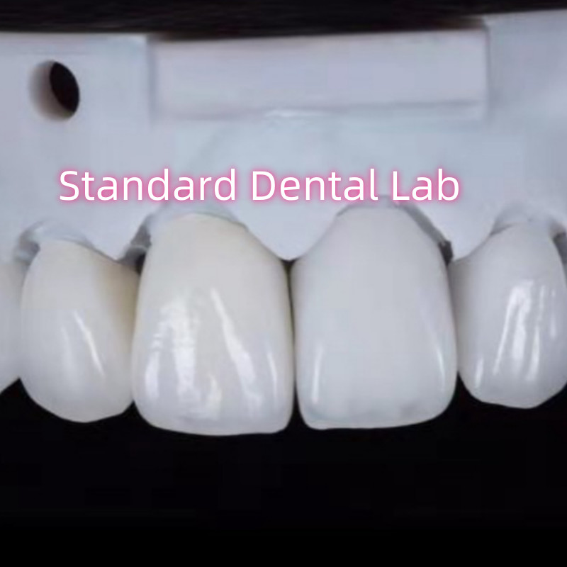 Natural Looking Restorations Aidite Dental Zirconia Tooth Crown