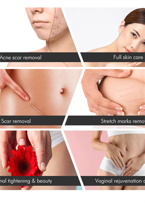 RF Acne Scar CO2 Fractional Laser Machine 10600nm For Fine Lines Removal