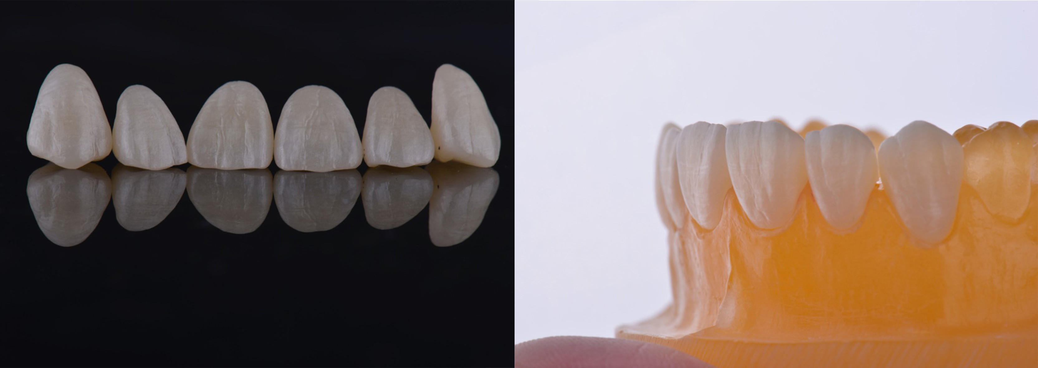 CAD CAM Milling 1530 ℃ 1350Mpa Dental Zirconia Disc