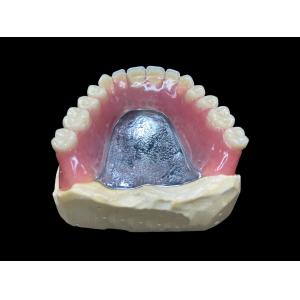 Easy-to-Clean Custom Cast Partial Dentures Ideal for Restoring Chewing Ability