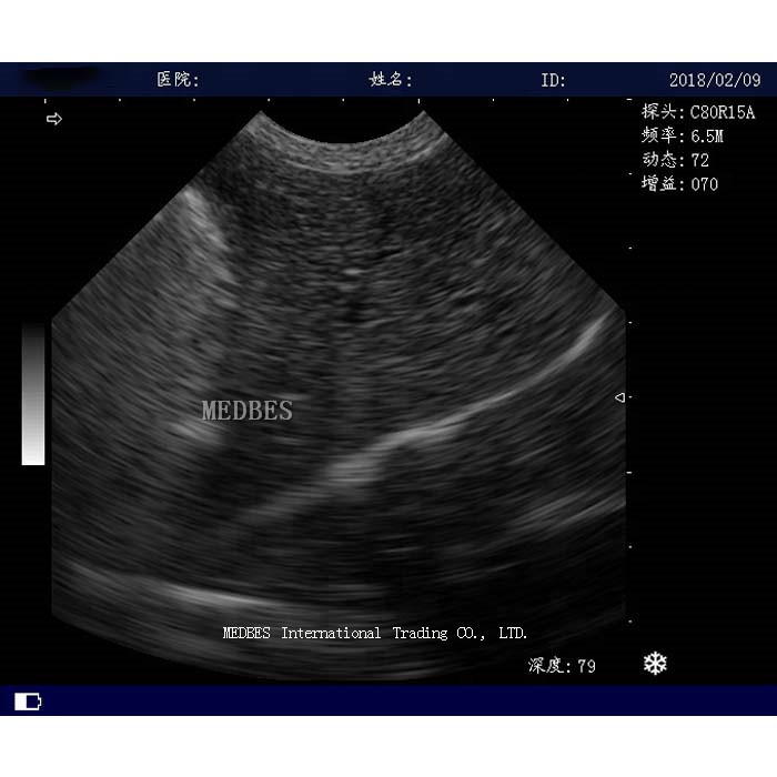 Full digital hospital cheapest 4D trolley color doppler laptop portable