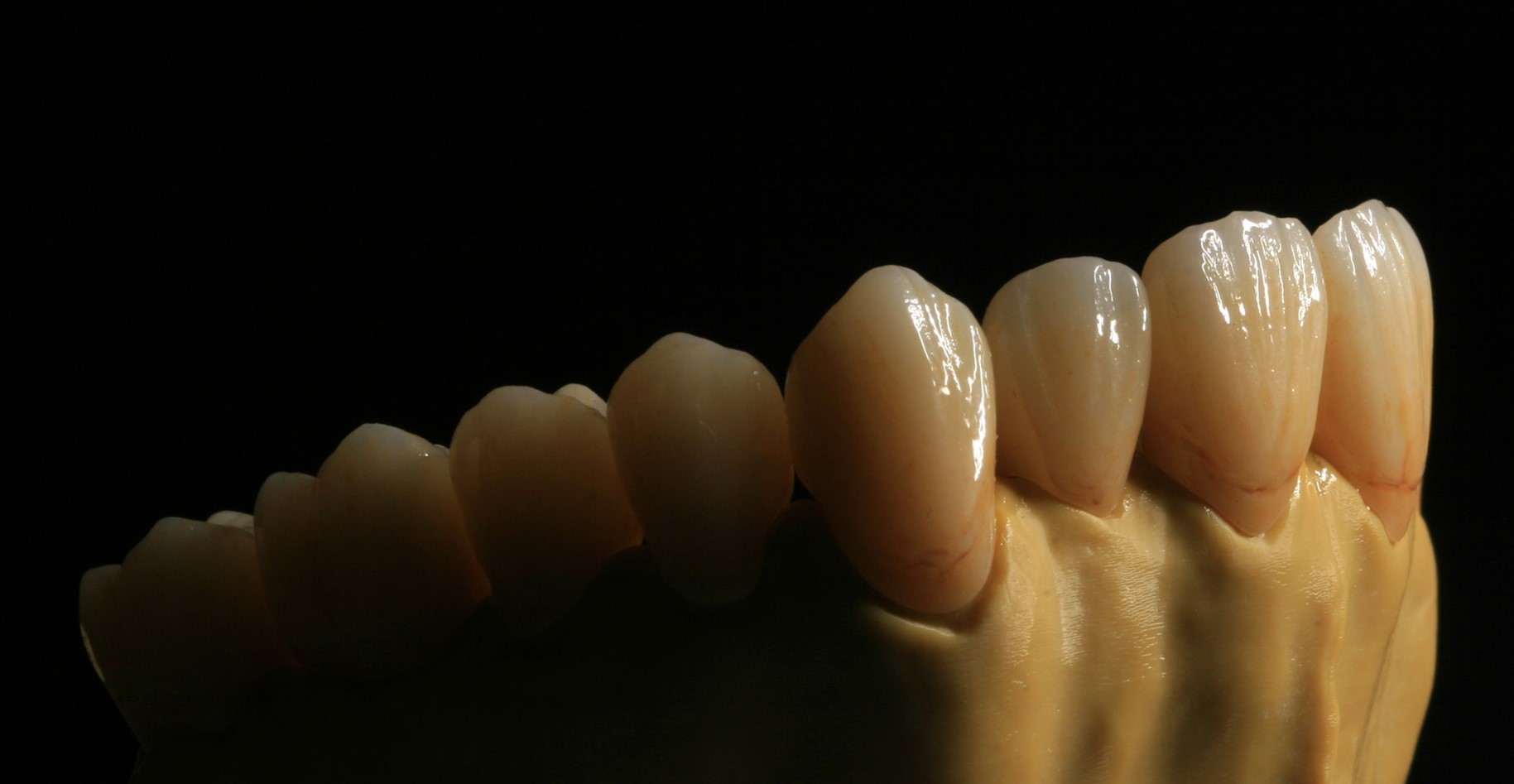 Dental Laboratory Zirconium Oxide Porcelain Zirconia Dental Crown With Ceramic