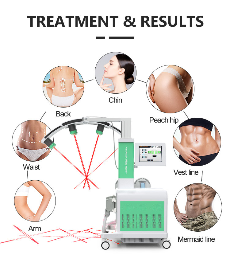532 nm Diode Cold Laser Fat Removal Machine Fat Reduction Weight Loss Ems Body Slimming 10d LIPO LASER with EMS Machine
