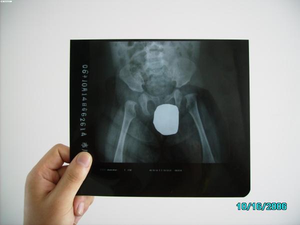 Silver Halide Laser X Ray Medical Imaging Waterproof Thin Agfa DRYSTAR DT1B /