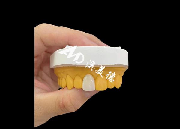 Anterior incisor Zirconia Dental Crown Natural Looking High Strength Wear