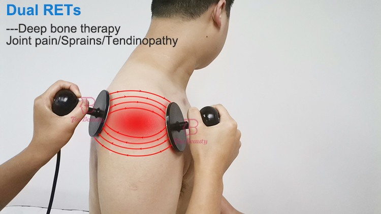 Indiba Tecar Diathermy Radiofrequenza Pain Relief Profesional 448 khz Rf Tecar Therapy