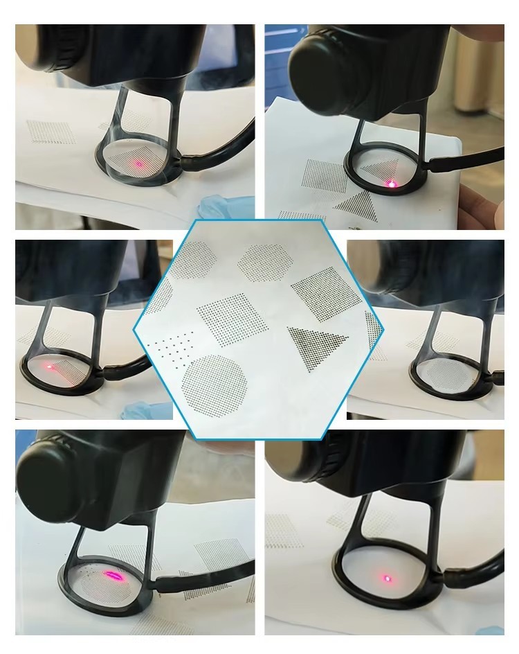 Surgical Fractional Co2 Laser Yag Laser Carbon Acne Scar Removal Wrinkle Reduction Machine