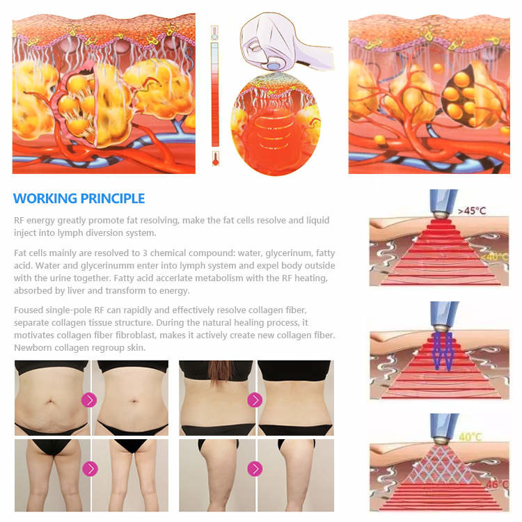 Focused Rf Ultrasound Body Slimming Face Lifting Machine Cell Regeneration