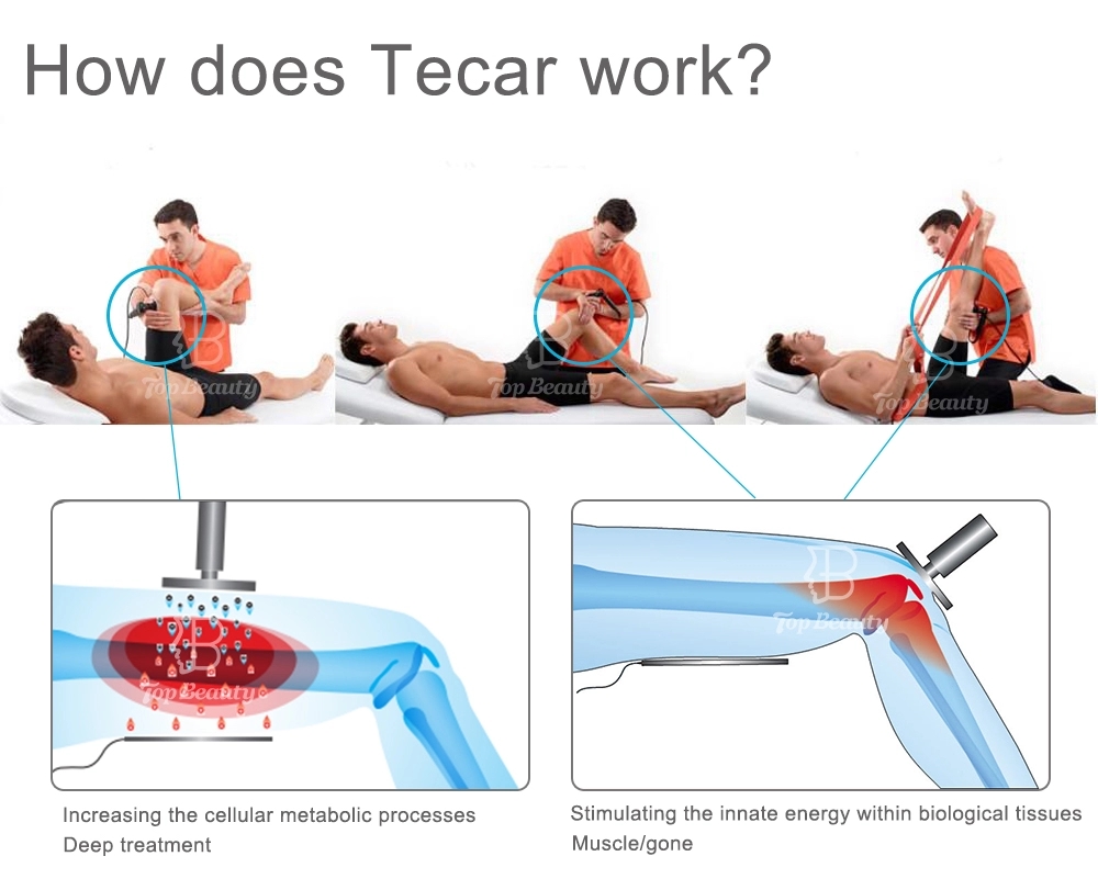 Touch screen 448khz Laser Beauty Equipment Tecar Therapy Weight Loss