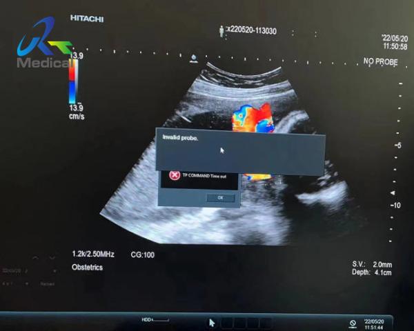 Invalid Ultrasound Machine Repair Hitachi ARIETTA 60 Occasional Hints That Probe