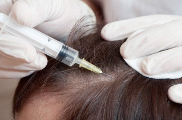 5ml Youth Serum Injection Head Skin Care PRP Injection For Hair Growth
