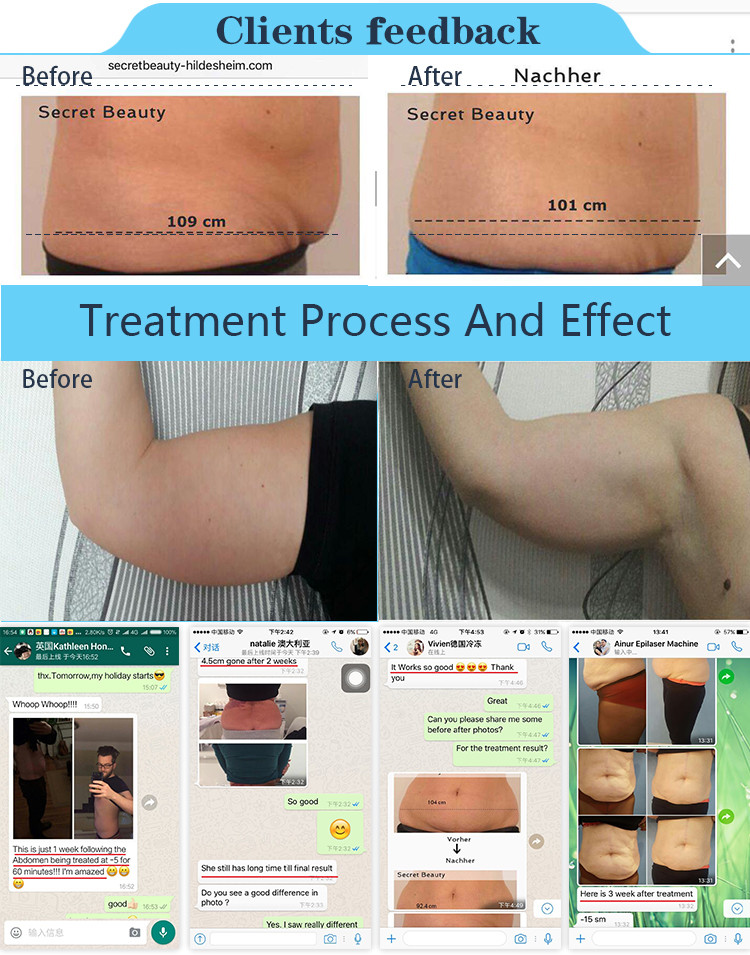 2018 high quality cro+RF+cavitation Multifunction Beauty machine, two handles work together