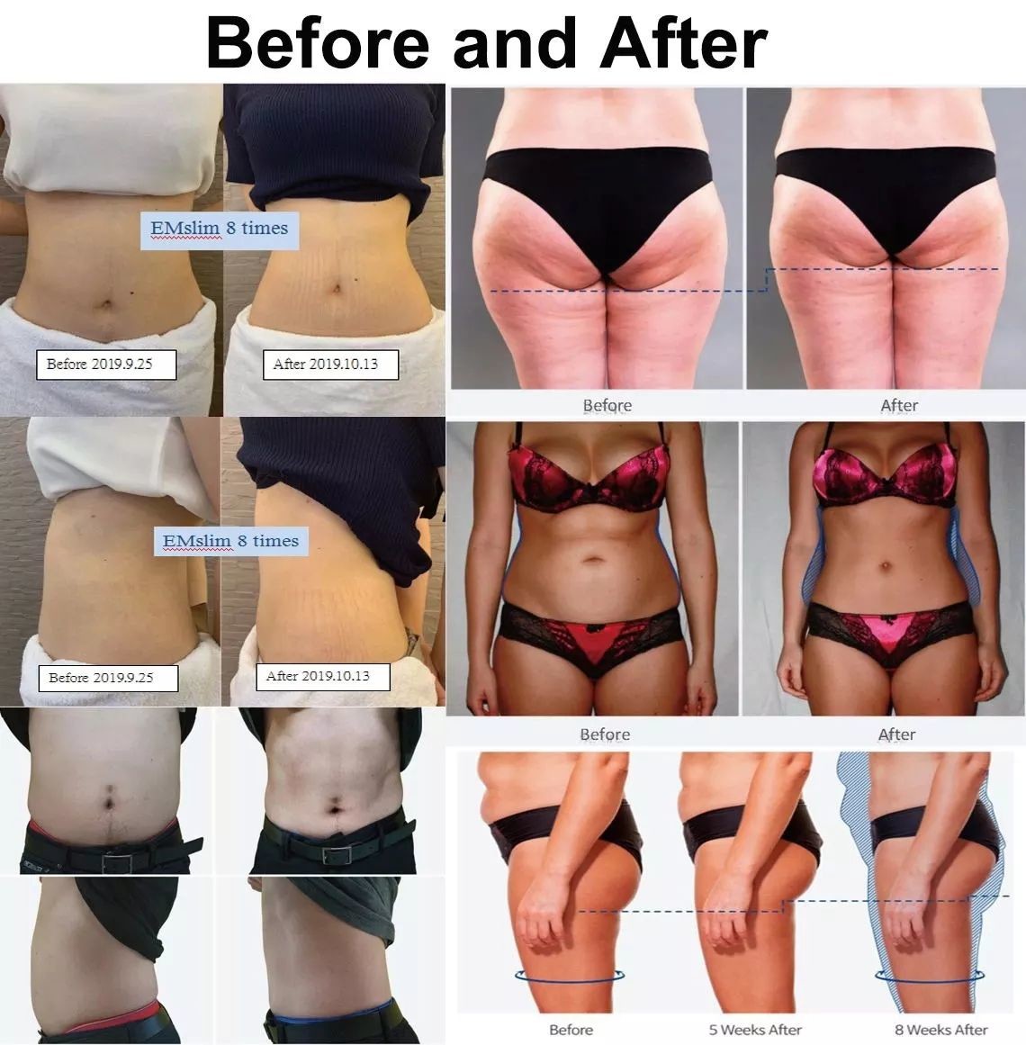 300us Slim Beauty Machine EM Sculpting 4 In 1 Cavitation Machine Muscle Stimulator