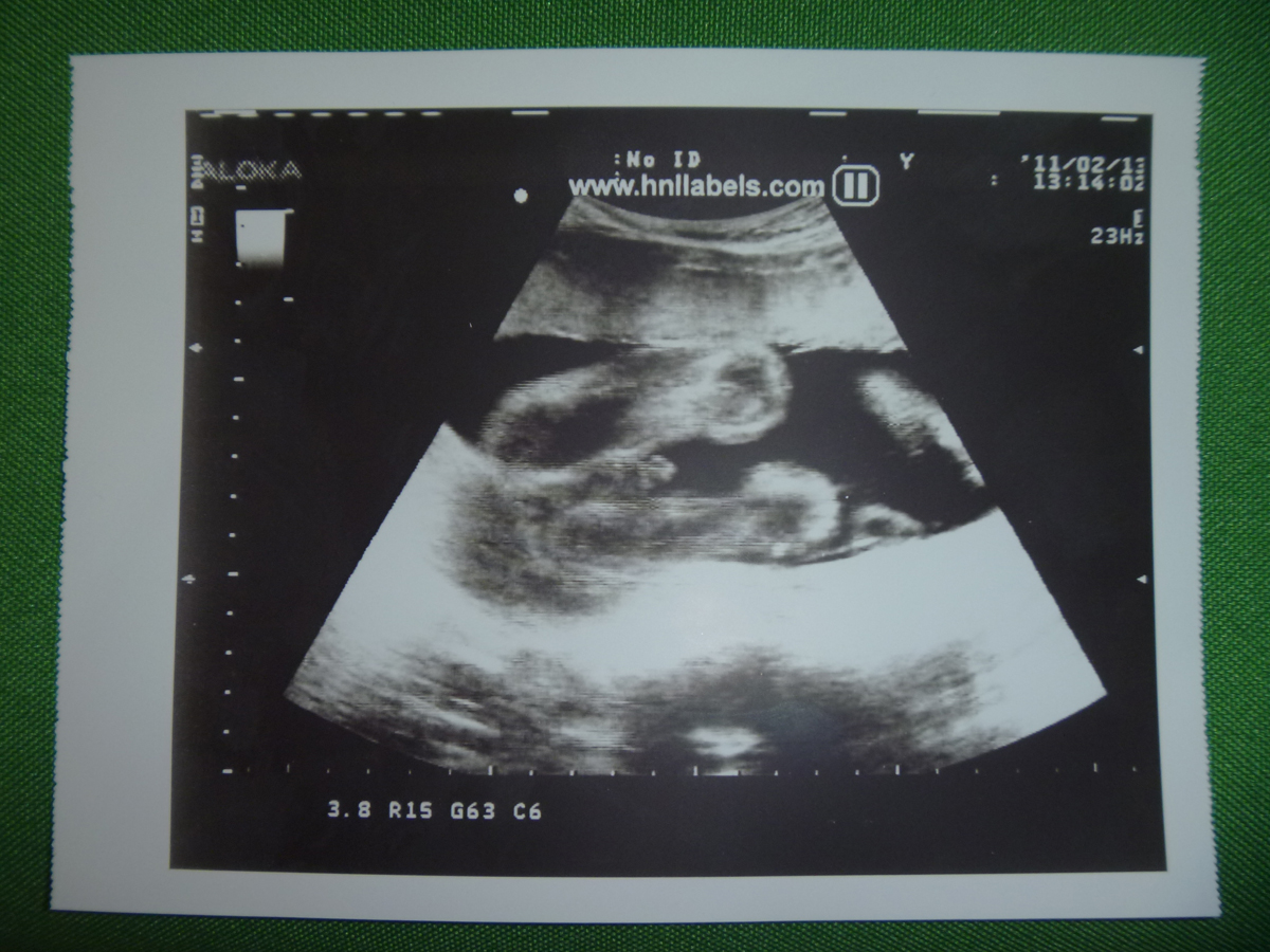 upp-110s,sony ultrasound paper, sony upp-110s