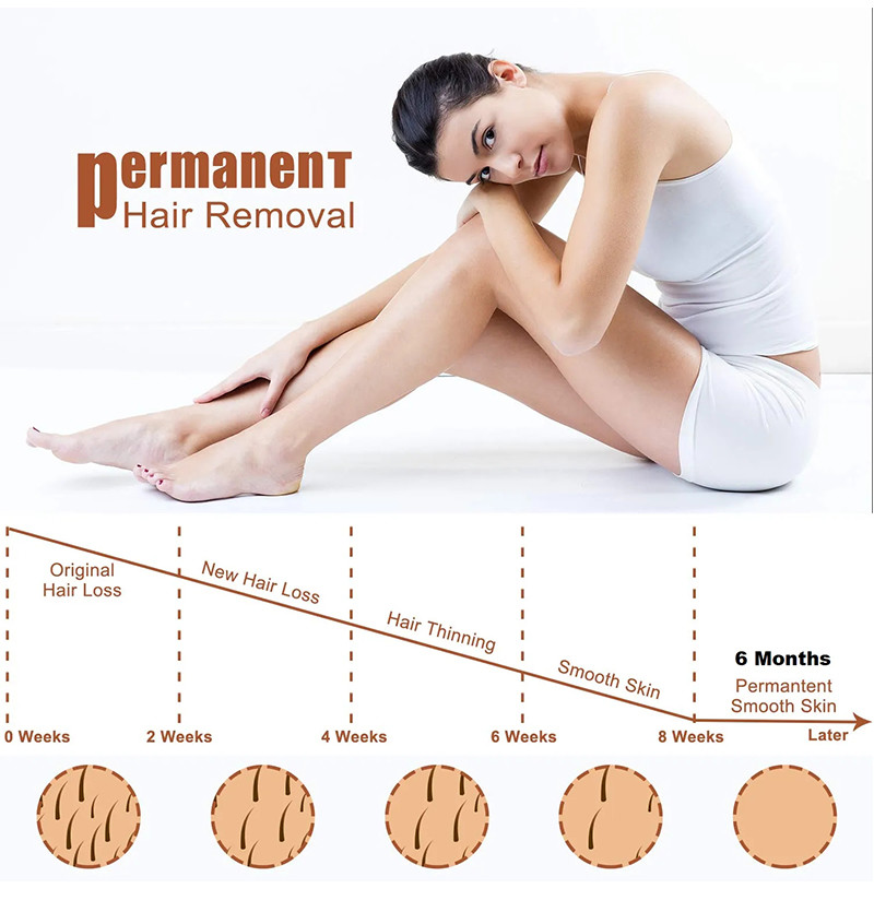 Cutting-Edge Diode Laser Hair Removal Machine for Flawless Skin