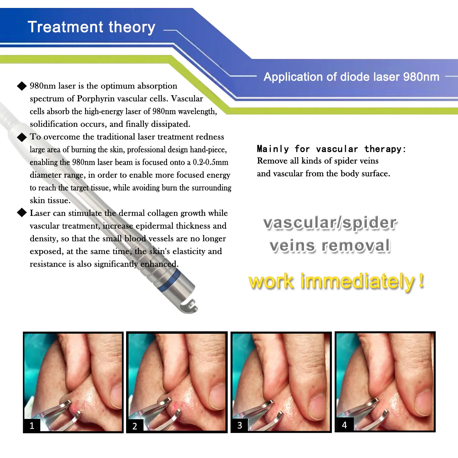 Portable 30w Vascular Laser Spider Vein Removal Machine Facial Leg 980nm Diode