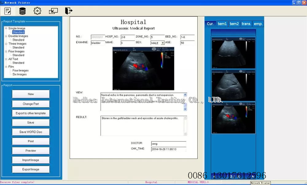 colorful portable veterinary ultrasound popular using in hospital Laptop doppler