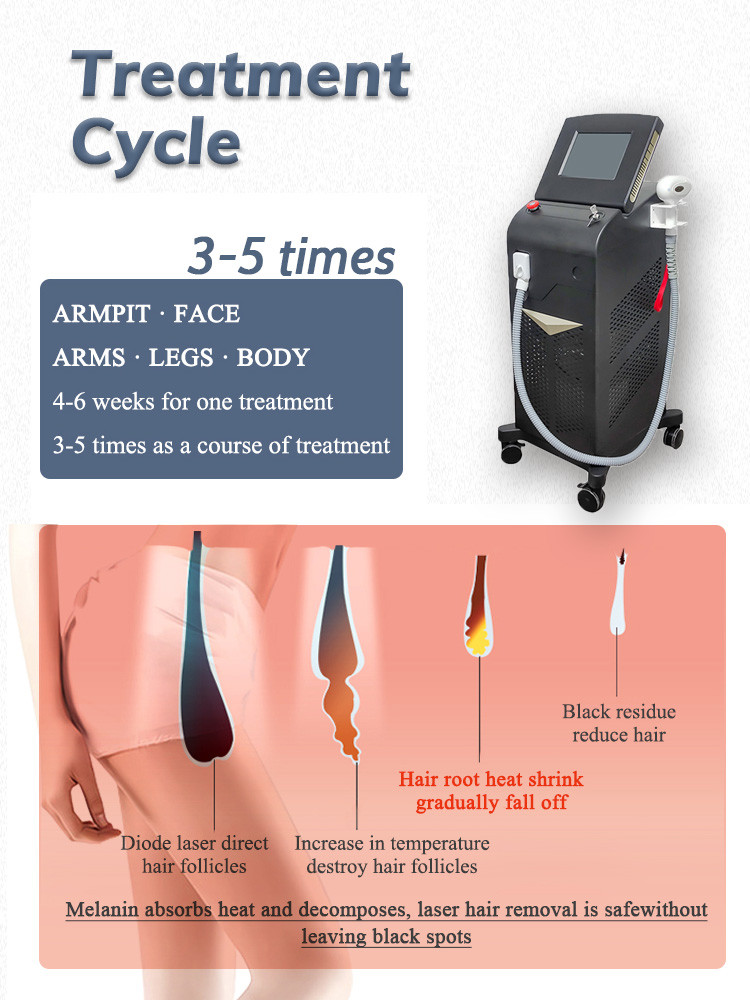 vertical professional diode laser 808nm hair removal machine / Newest Best price 808nm diode laser hair removal machine
