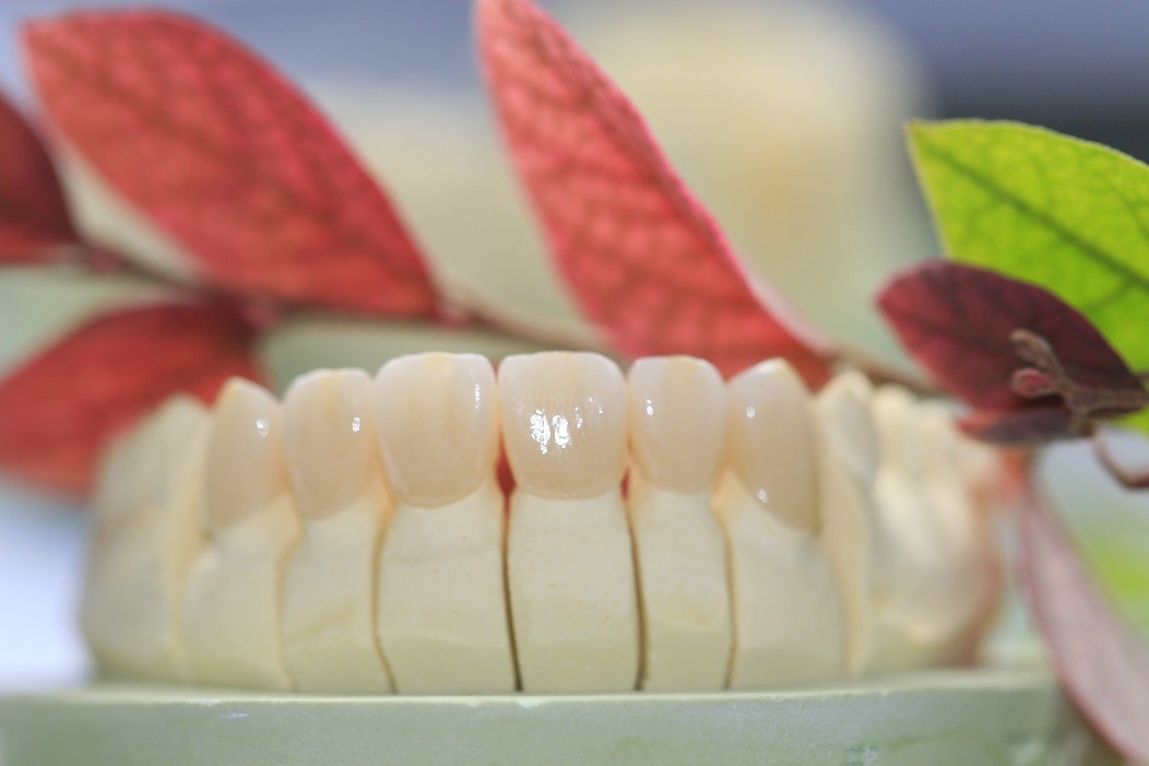 Dental Laboratory Zirconium Oxide Porcelain Zirconia Dental Crown With Ceramic