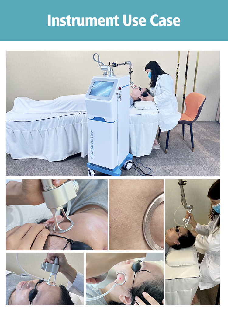 Fractional CO2 Laser Machine For Professional Beauty And Aesthetic Treatments