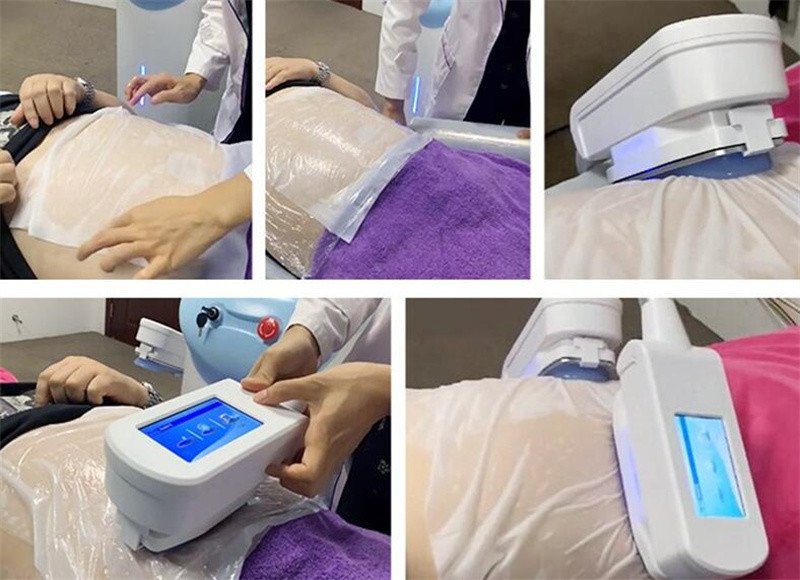 360 Degree Working Cryo Weight Loss Machine Body Sculpting And Reduce Fat