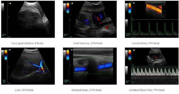 Color Doppler Ultrasound System Portable Ultrasound Scanner With 12.1 Inch LED Monitor And 2 Probe Ports