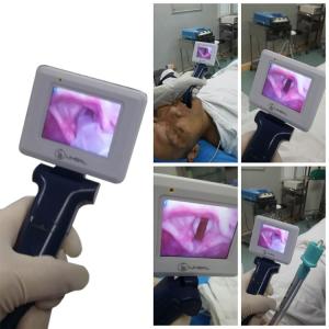  Operating Portable Video Laryngoscope Using In Routine Endotracheal Intubation Manufactures