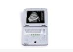  Mobile Ultrasound Machine Digital Laptop Ultrasound Scanner with 100 Frames Permanent Storage Manufactures