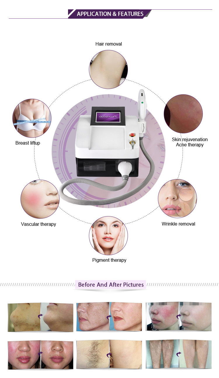 E Light IPL RF 3 in 1 Multifunction Beauty Machine For Hair Removal CE