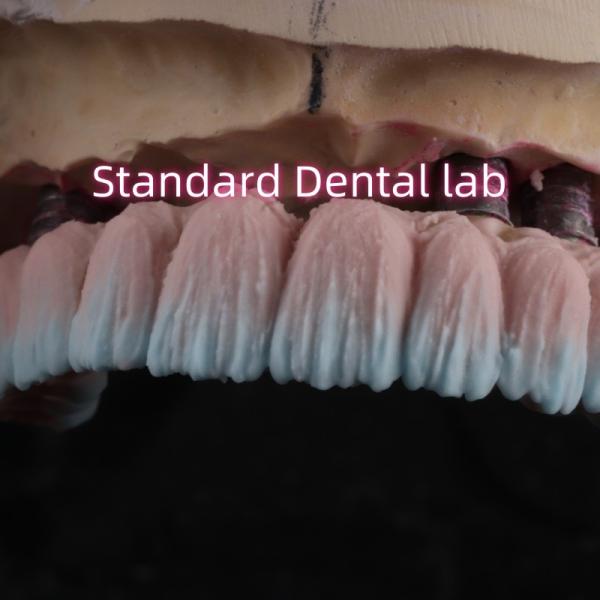 Quality Zirconia Implant Bridge Screw Retained With Pink Gum Porcelain for sale