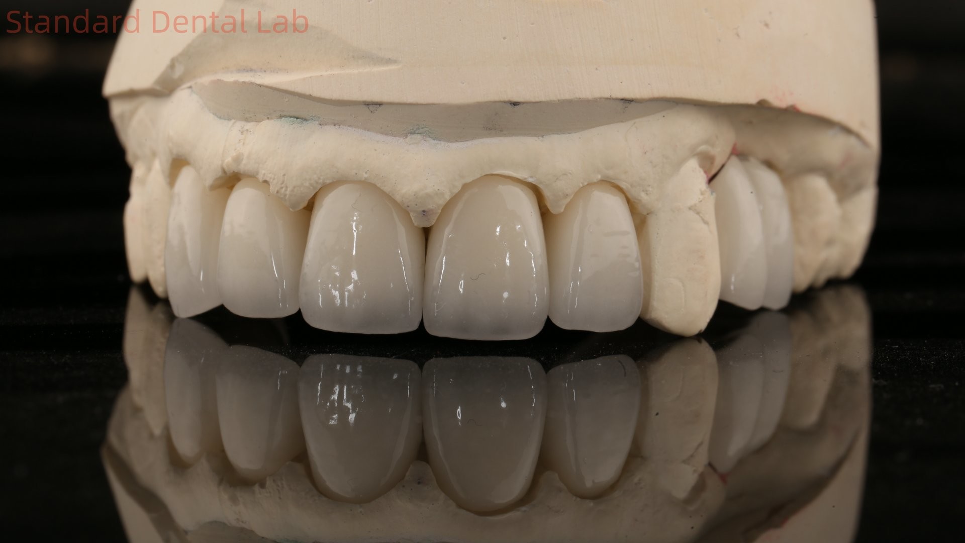 China Dental Lab Zirconia Full Contour Crown High Aesthetic Natural Dental Bridge 5 Year Guarantee