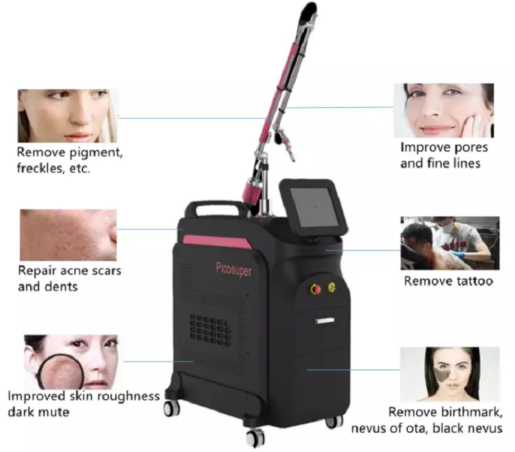 Painless Q Switch Tattoo Removal Machine Professional Tattoo Removal Machine 532nm
