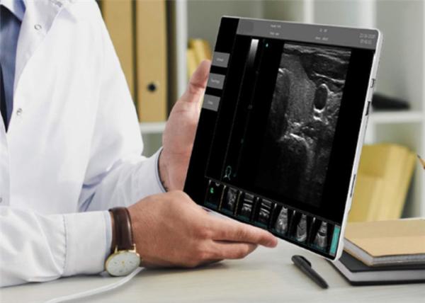 Portable Ultrasound Unit Portable Ultrasound Scanner 4 Types of Probes Available