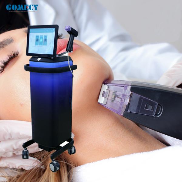 Morpheus8 RF Micro-Needling System: Anti-Acne, Skin Firmness, Stretch Marks,