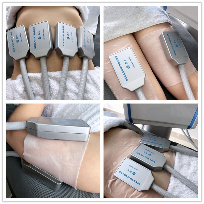 20Hz Cryolipolysis Fat Freezing Machine With EMS Muscle Stimulate