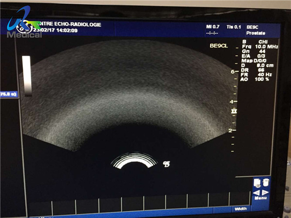 Used Ge Logiq E9 Probes 2nd Hand Ge Ultrasound Probes