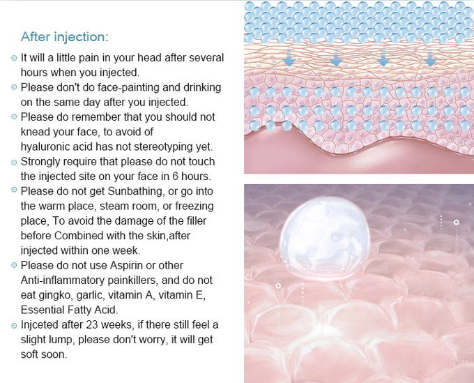 Transform Lips Hyaluronic Acid Lip Augmentation Filler Non Surgical Lip Enhancement