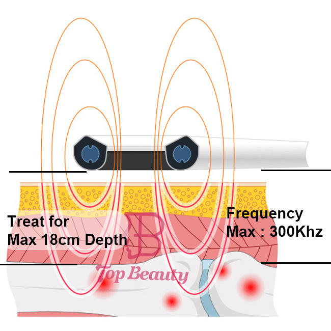 Touch Screen Magnetic Therapy Device 300Khz Frequency Physical Musculoskeletal Therapy Machine