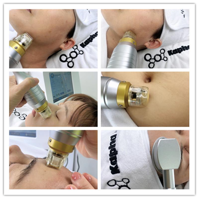 Body Collagen Induction 220V Microneedling Fractional RF