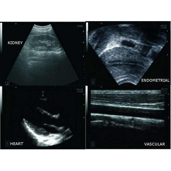 Mobile Full Digital Portable Ultrasound Machine Wireless With 6 Inch LCD Touch