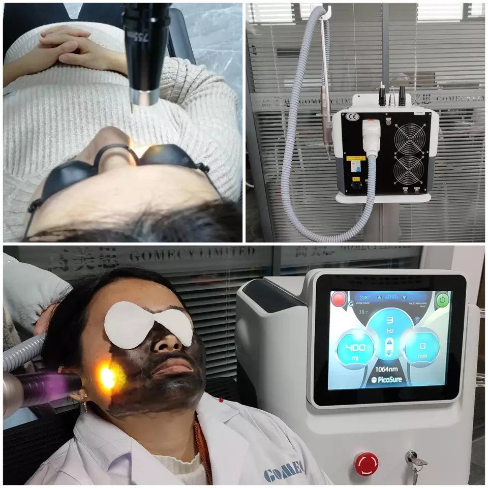 2023 New Design Black Picosecond Laser Carbon Peeling Tattoo Removal Machine
