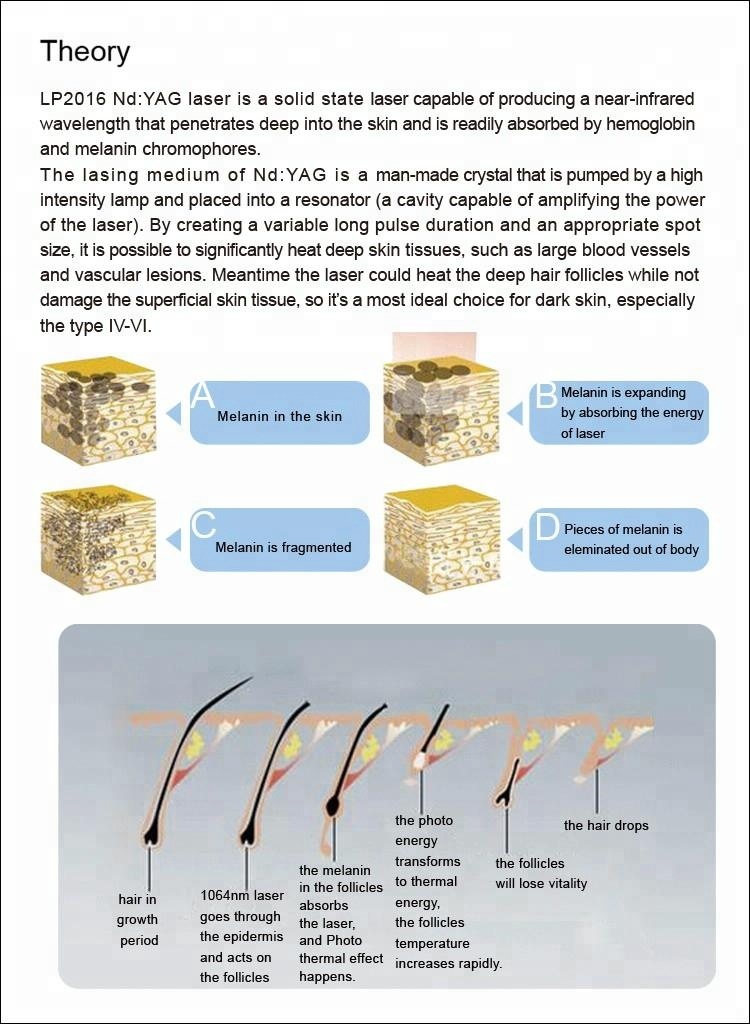 Long Pulsed ND YAG Laser Hair Removal Machine , 1064nm Laser Vein Removal Machine