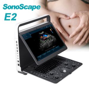 High Quality Ultrasonic SonoScape E2 with Ultrasonic Sensors