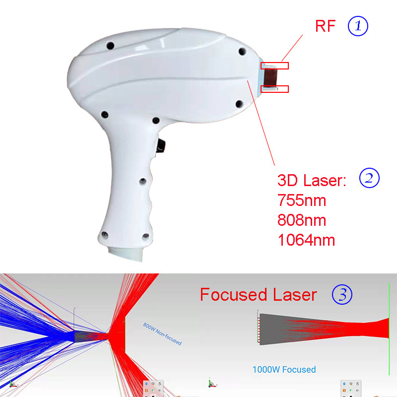 Hot Selling Diode Laser + RF integrated Diode+RF RDRF 600-1000W for Hair Removal