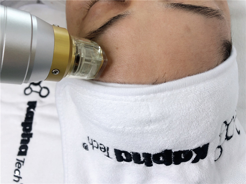 Thermal Cooling 10.4 Inch Microneedling Fractional RF Face Lifting