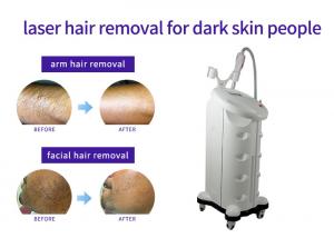  Solid State Laser Hair And Tattoo Removal Machine , Industrial Laser Hair Removal Machine Manufactures