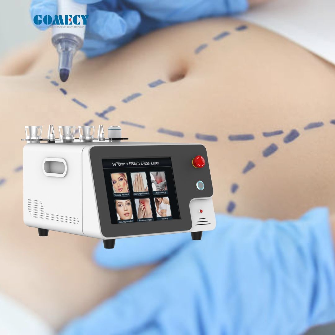 Endolaser Diodo 980 Nm 1470nm Portable Fiber Optic Laser Machine Face Lifting Liposuction Features Skin Weight Loss Cool