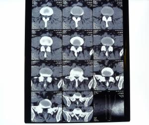  Waterproof Holographic X Ray Dry Film KND-A For Thermal Printer , AGFA 5300 / 5500 / 5302 Manufactures